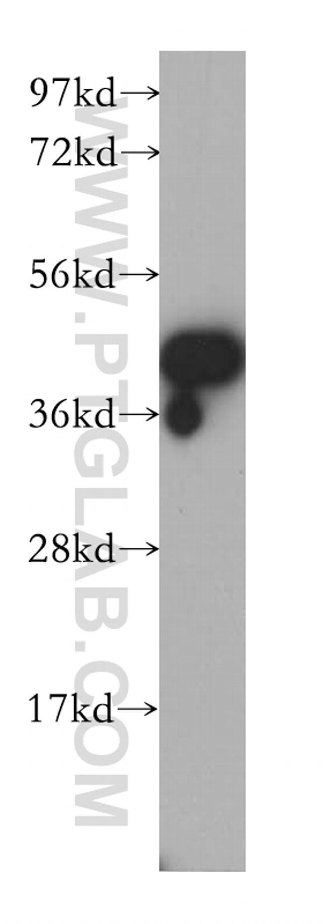 LAMR1/RPSA Antibody in Western Blot (WB)