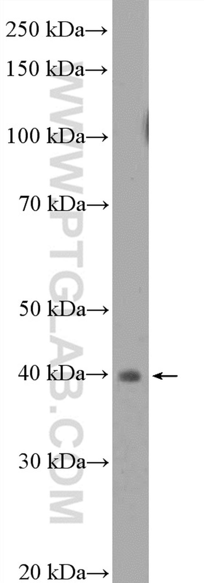 LAMR1/RPSA Antibody in Western Blot (WB)