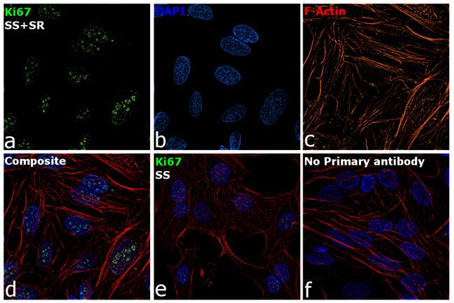 Ki-67 Antibody