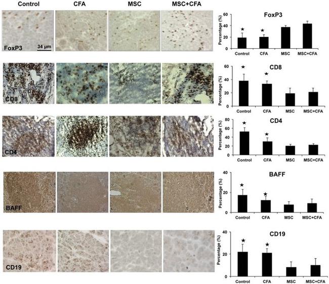 FOXP3 Antibody in Immunohistochemistry (IHC)