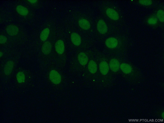 ERCC1 Antibody in Immunocytochemistry (ICC/IF)