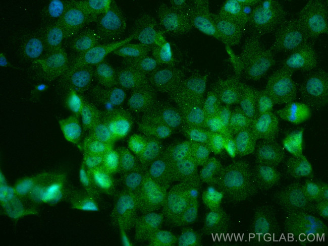 NRARP Antibody in Immunocytochemistry (ICC/IF)