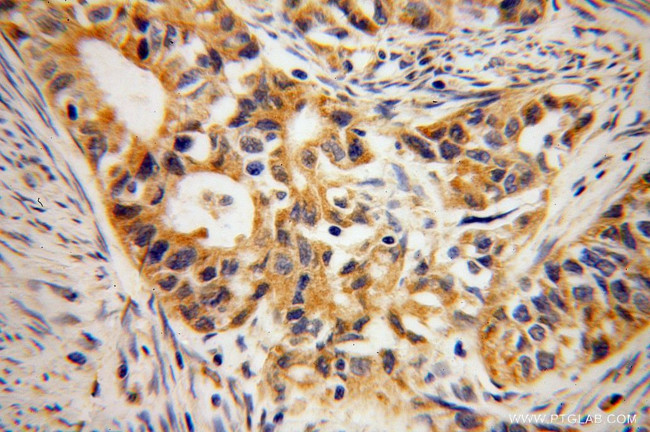 B3GALTL Antibody in Immunohistochemistry (Paraffin) (IHC (P))