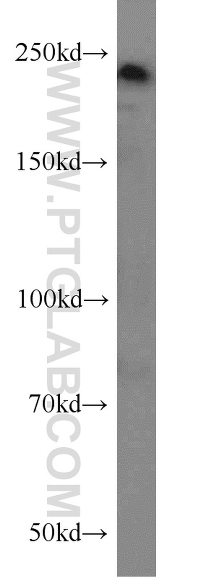 MYO18A Antibody in Western Blot (WB)