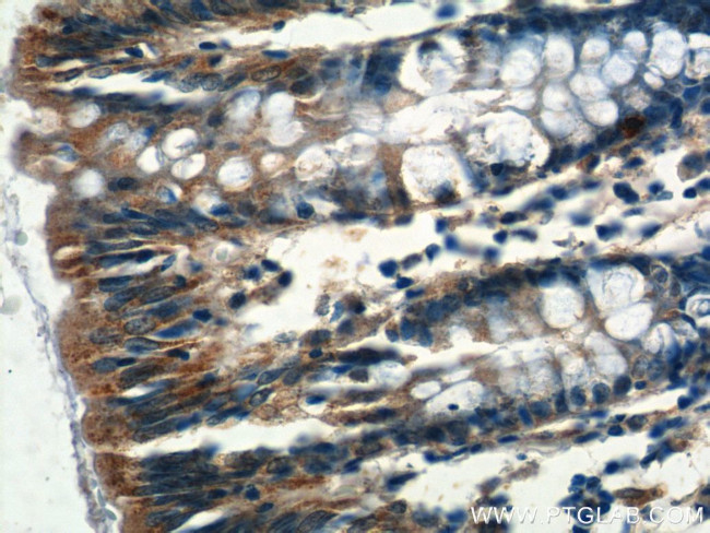 NMUR1 Antibody in Immunohistochemistry (Paraffin) (IHC (P))