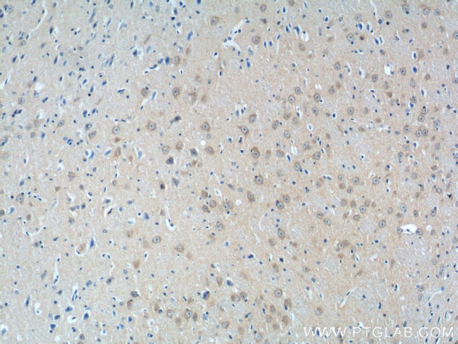 NMUR1 Antibody in Immunohistochemistry (Paraffin) (IHC (P))