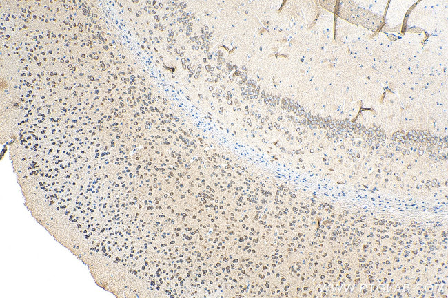 NMUR1 Antibody in Immunohistochemistry (Paraffin) (IHC (P))