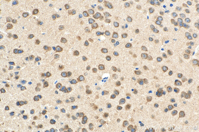 NMUR1 Antibody in Immunohistochemistry (Paraffin) (IHC (P))