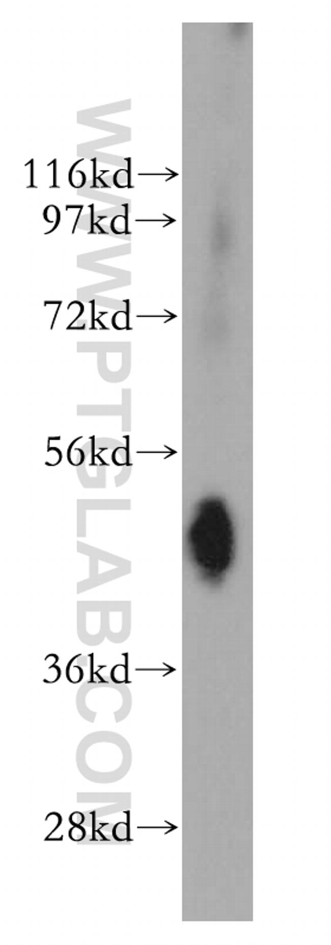 NMUR1 Antibody in Western Blot (WB)