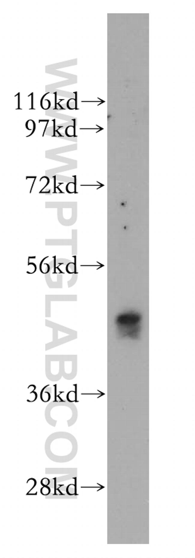 NMUR1 Antibody in Western Blot (WB)