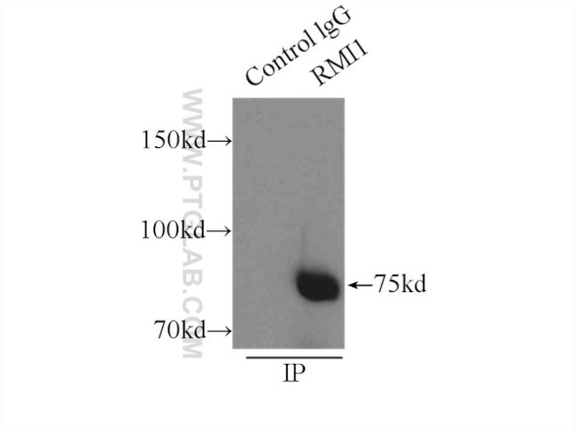 RMI1 Antibody in Immunoprecipitation (IP)