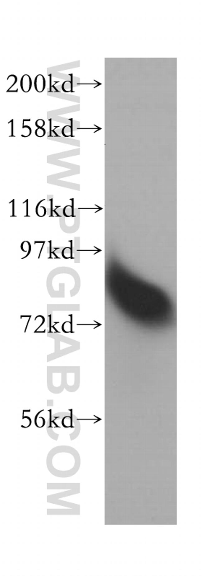 RMI1 Antibody in Western Blot (WB)