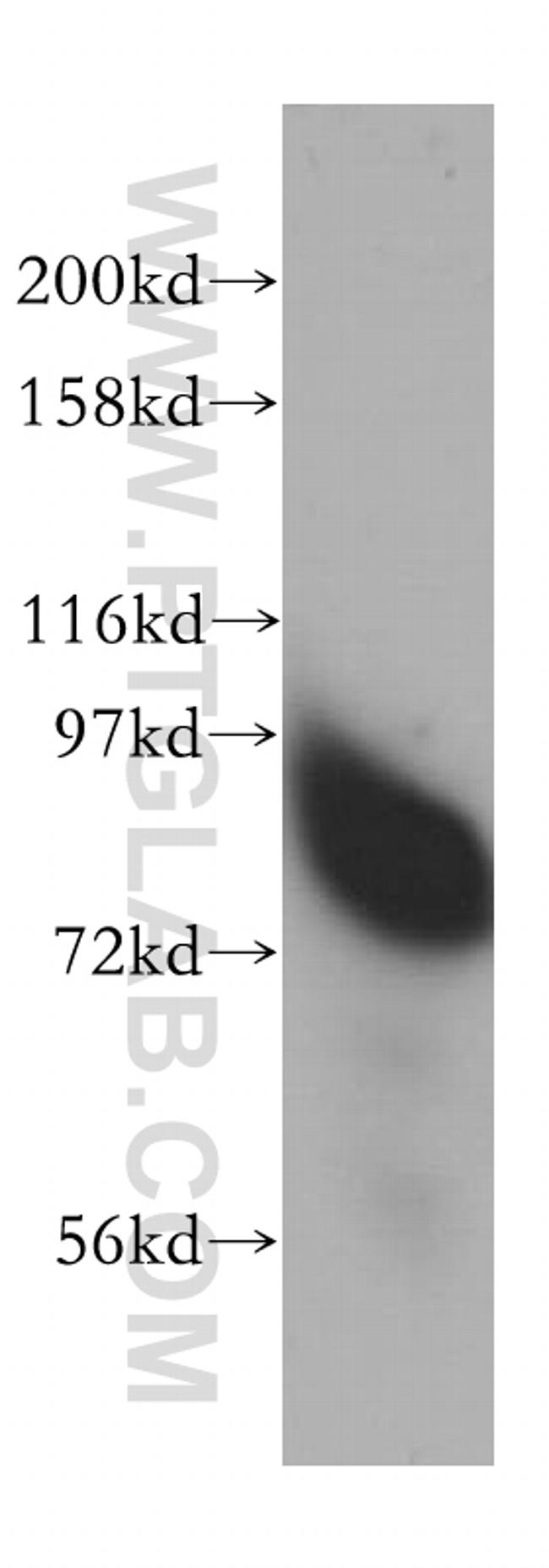 RMI1 Antibody in Western Blot (WB)