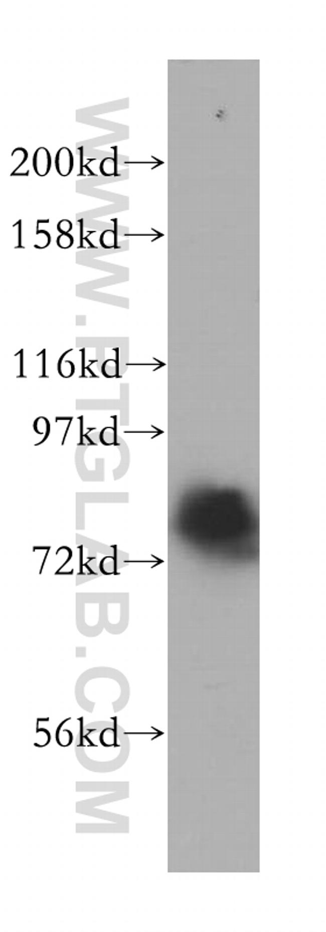 RMI1 Antibody in Western Blot (WB)