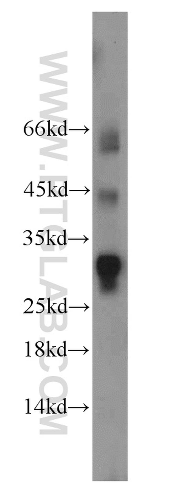 RPL13A Antibody in Western Blot (WB)