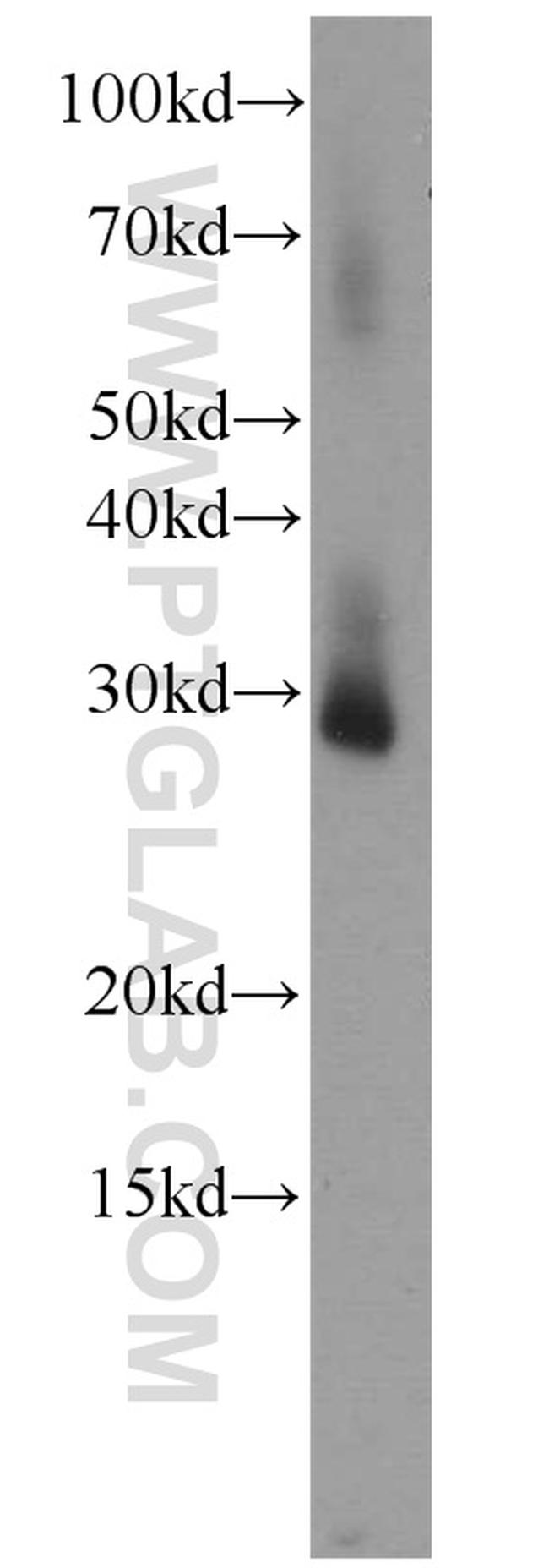 RPL13A Antibody in Western Blot (WB)