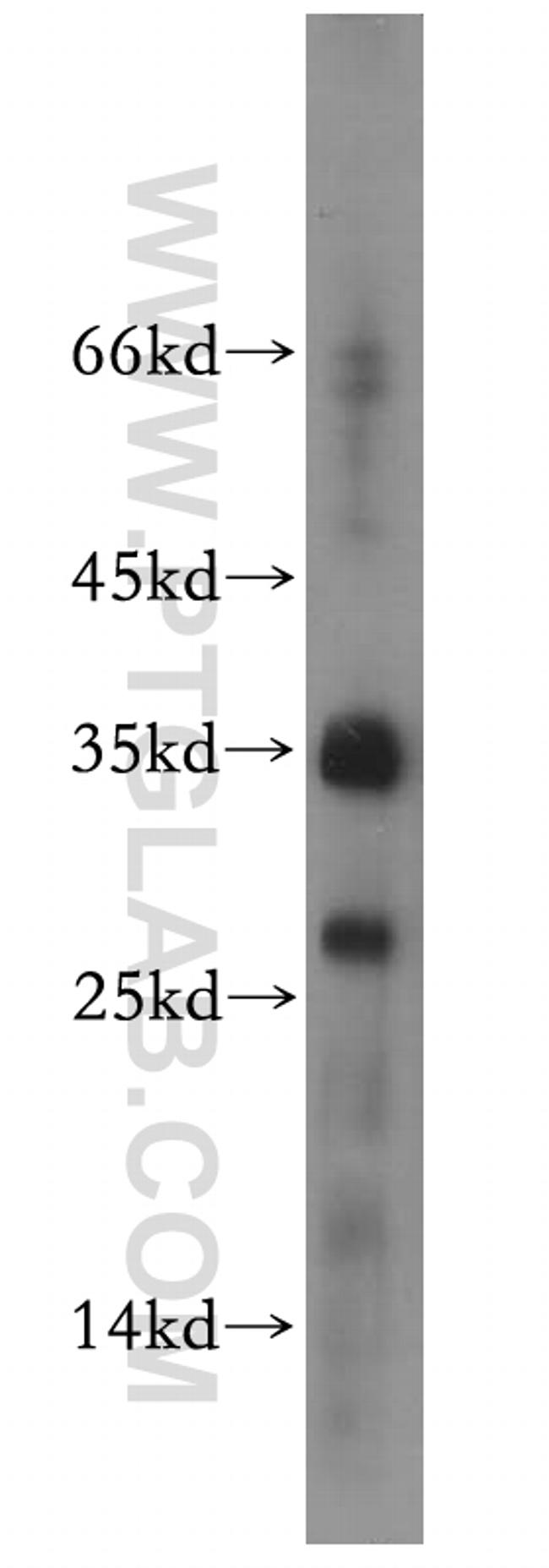 RPL13A Antibody in Western Blot (WB)