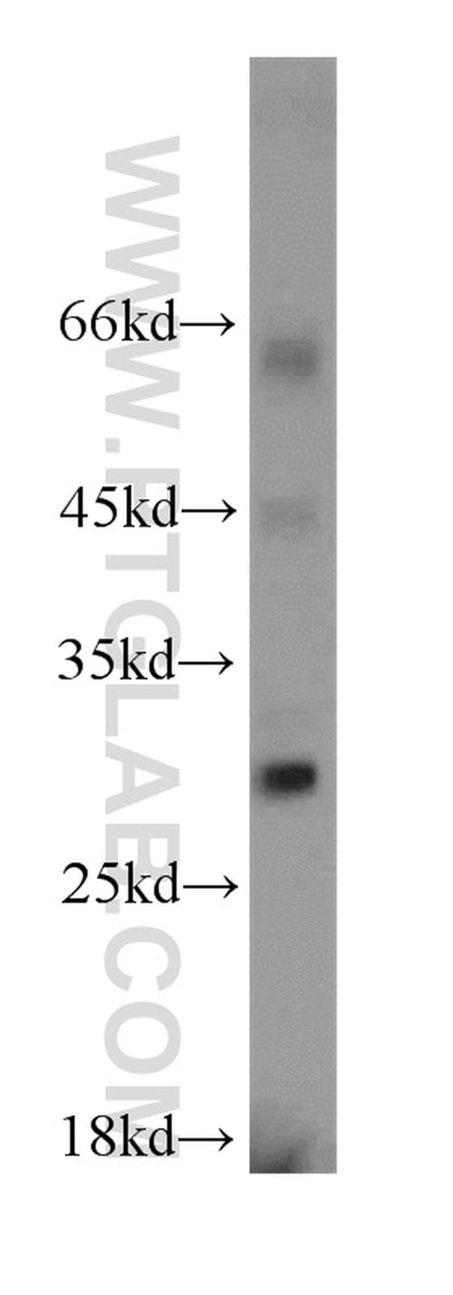 RPL13A Antibody in Western Blot (WB)