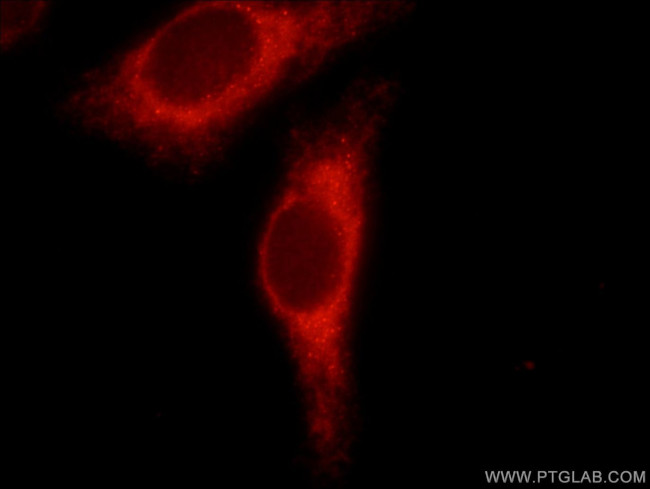 PPP1R15B Antibody in Immunocytochemistry (ICC/IF)