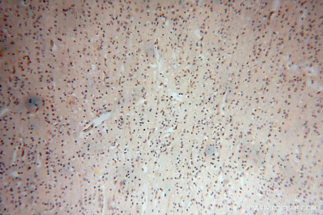 PPP1R15B Antibody in Immunohistochemistry (Paraffin) (IHC (P))