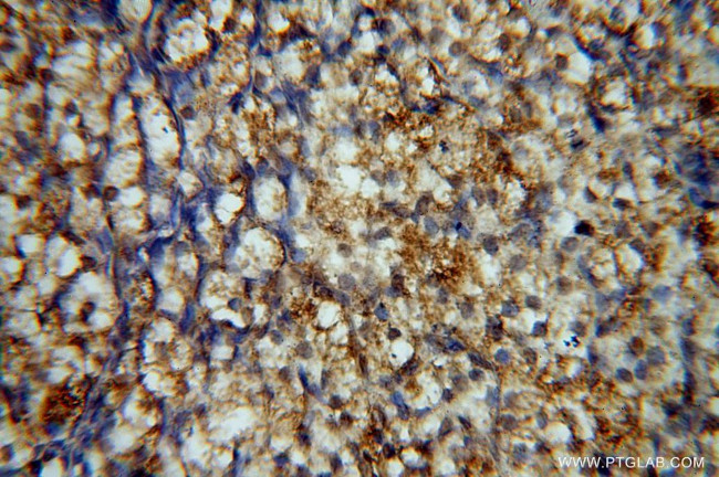 PPP1R15B Antibody in Immunohistochemistry (Paraffin) (IHC (P))