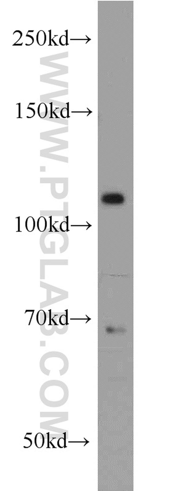 PPP1R15B Antibody in Western Blot (WB)