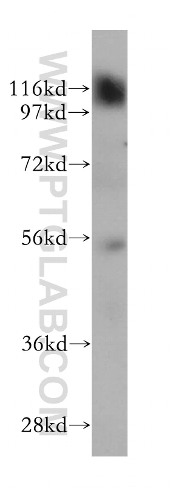 Beta adducin Antibody in Western Blot (WB)