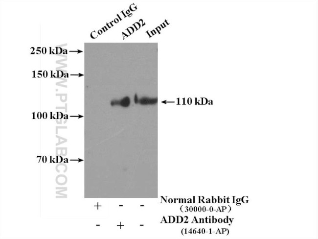 Beta adducin Antibody in Immunoprecipitation (IP)