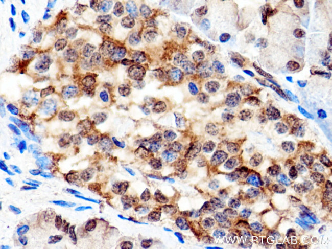 IGF2BP3 Antibody in Immunohistochemistry (Paraffin) (IHC (P))