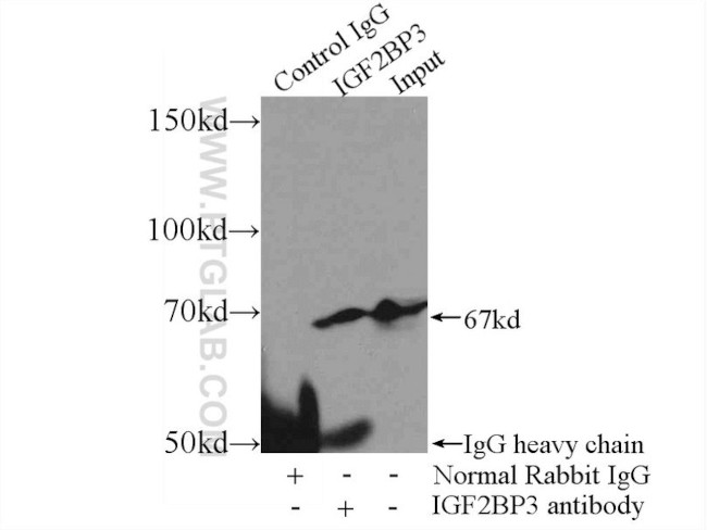 IGF2BP3 Antibody in Immunoprecipitation (IP)