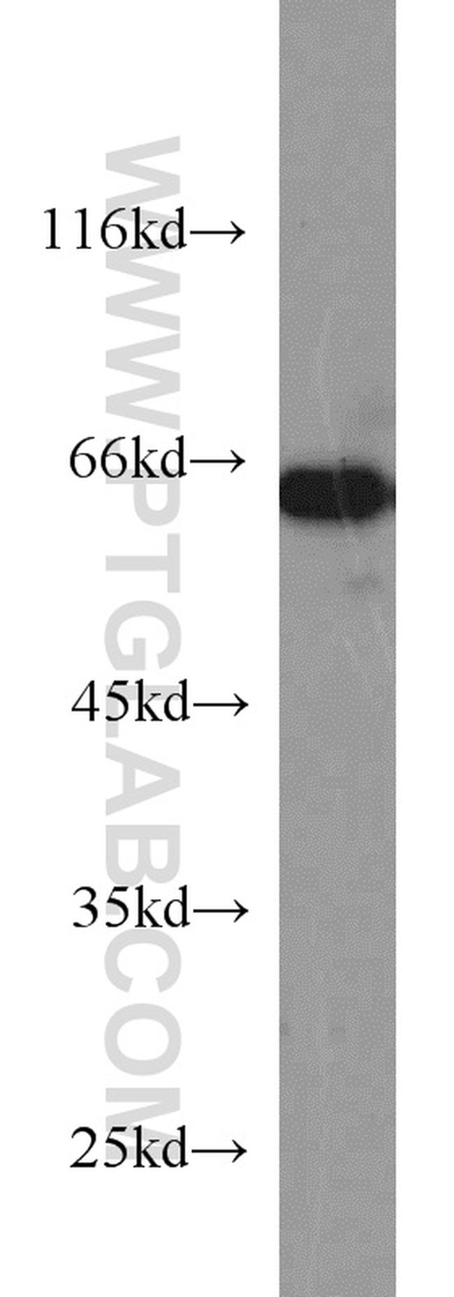 IGF2BP3 Antibody in Western Blot (WB)