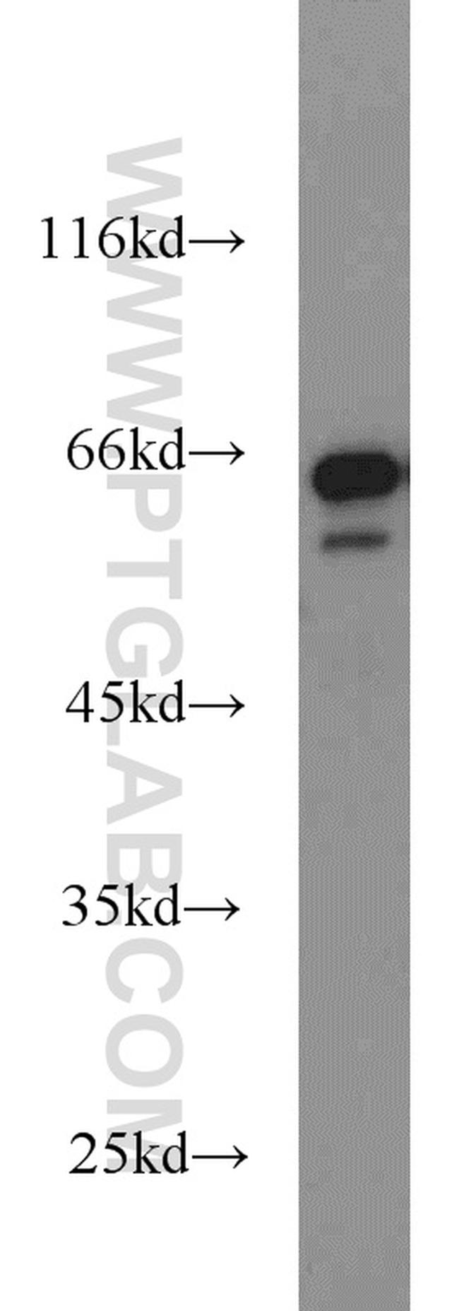 IGF2BP3 Antibody in Western Blot (WB)