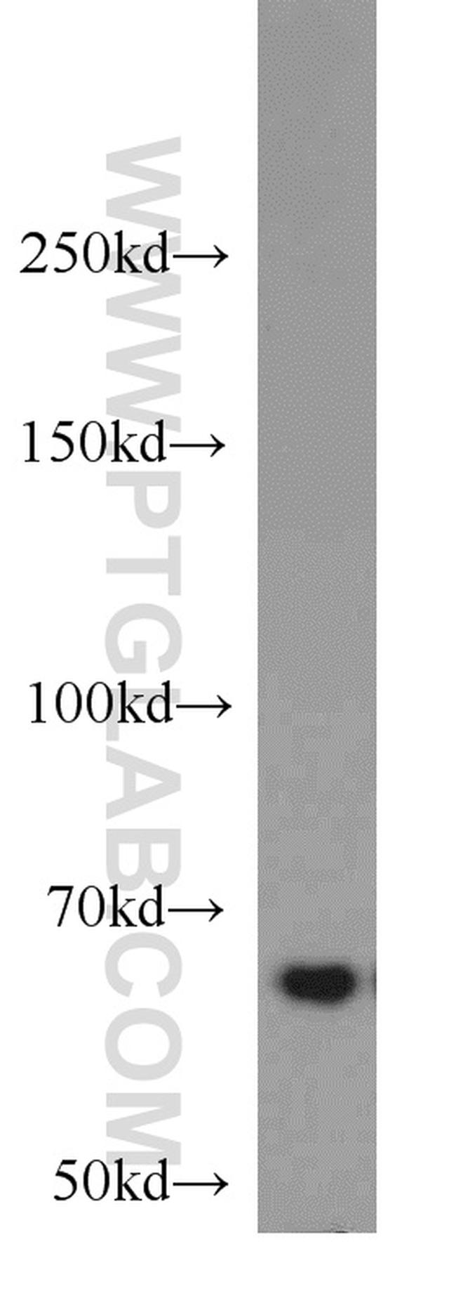 IGF2BP3 Antibody in Western Blot (WB)