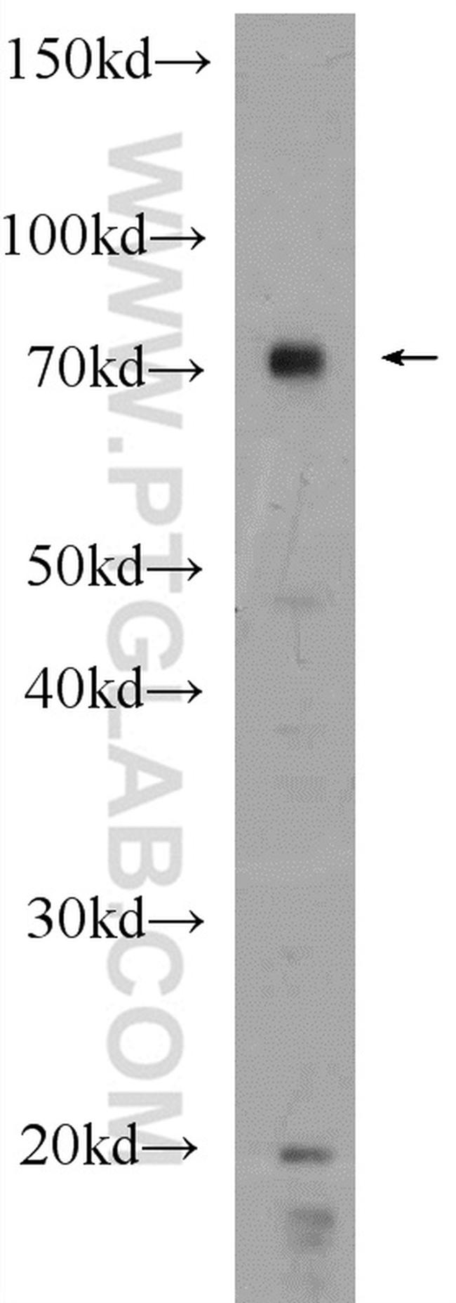 IGF2BP3 Antibody in Western Blot (WB)