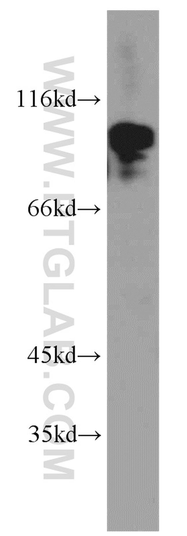 POSH Antibody in Western Blot (WB)