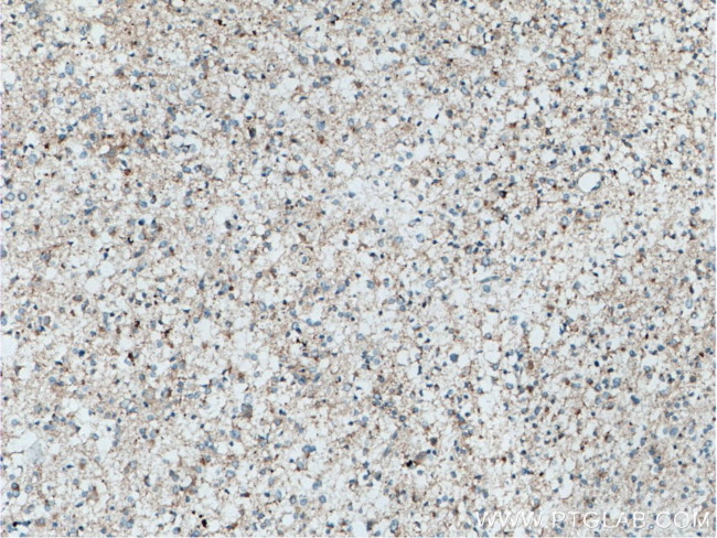 POSH Antibody in Immunohistochemistry (Paraffin) (IHC (P))