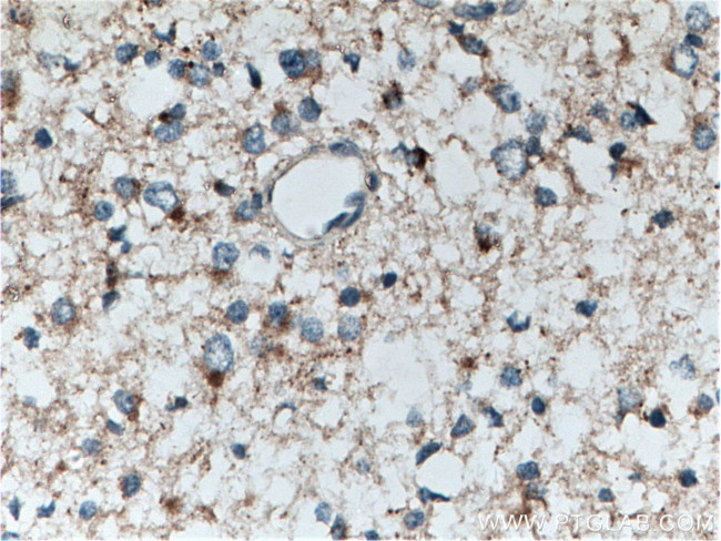 POSH Antibody in Immunohistochemistry (Paraffin) (IHC (P))