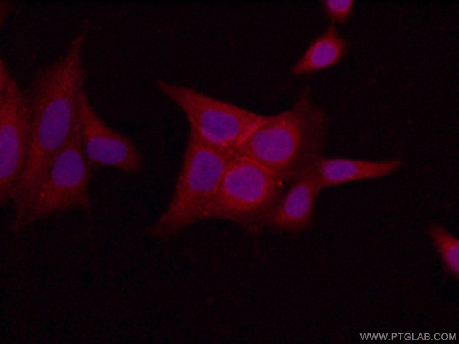LIN7C Antibody in Immunocytochemistry (ICC/IF)