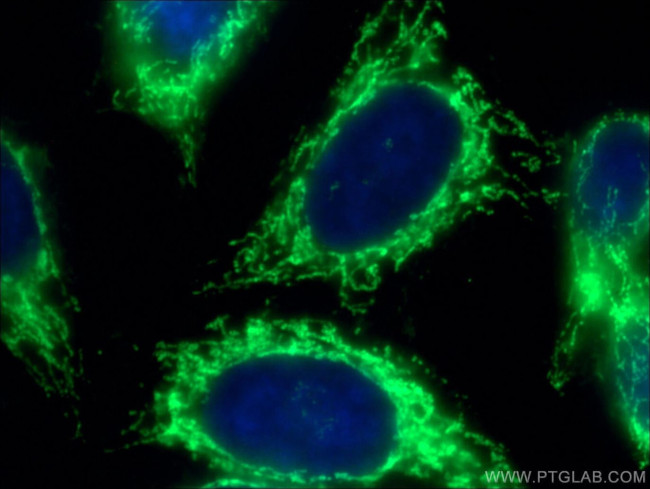 ATP5A1 Antibody in Immunocytochemistry (ICC/IF)