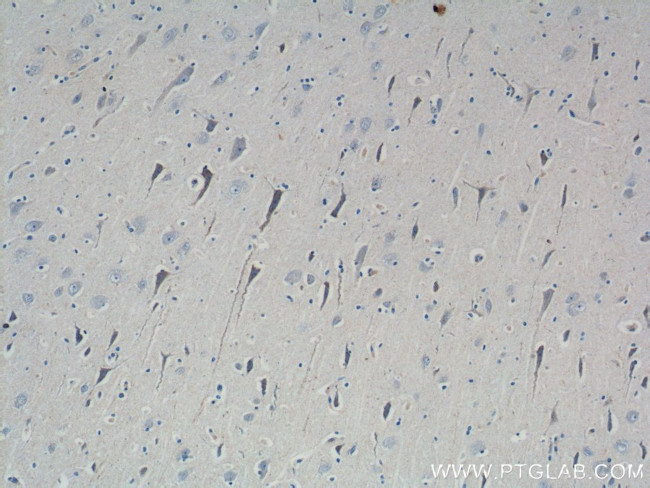 ATP5A1 Antibody in Immunohistochemistry (Paraffin) (IHC (P))