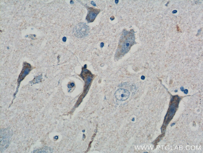 ATP5A1 Antibody in Immunohistochemistry (Paraffin) (IHC (P))