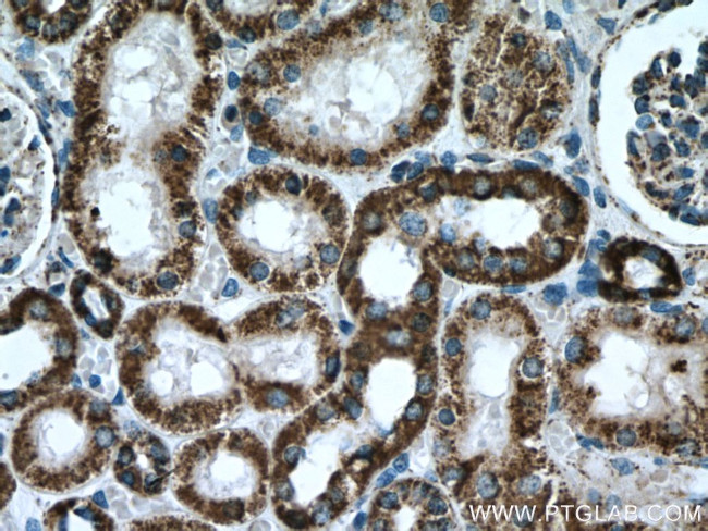 ATP5A1 Antibody in Immunohistochemistry (Paraffin) (IHC (P))