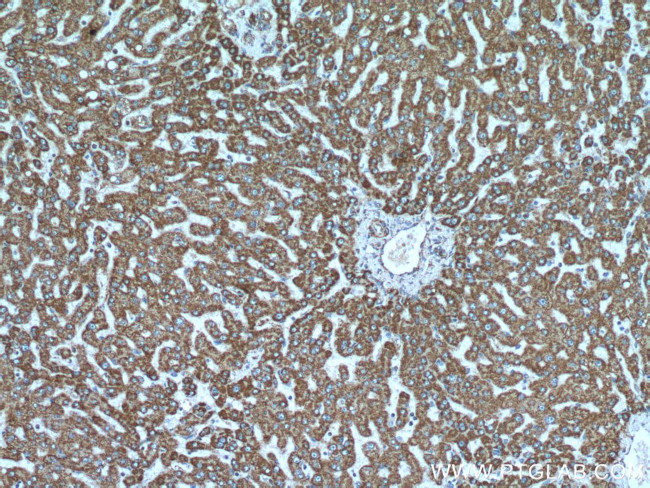 ATP5A1 Antibody in Immunohistochemistry (Paraffin) (IHC (P))