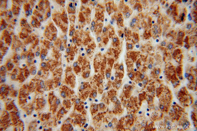 ATP5A1 Antibody in Immunohistochemistry (Paraffin) (IHC (P))