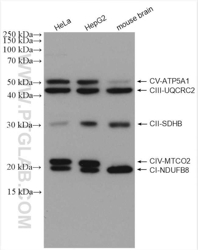 ATP5A1 Antibody in Western Blot (WB)