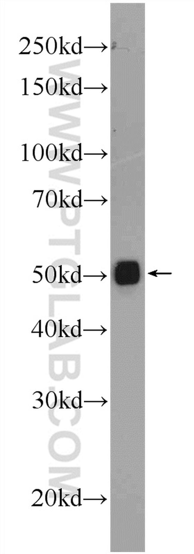 ATP5A1 Antibody in Western Blot (WB)