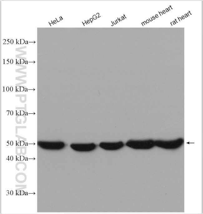 ATP5A1 Antibody in Western Blot (WB)