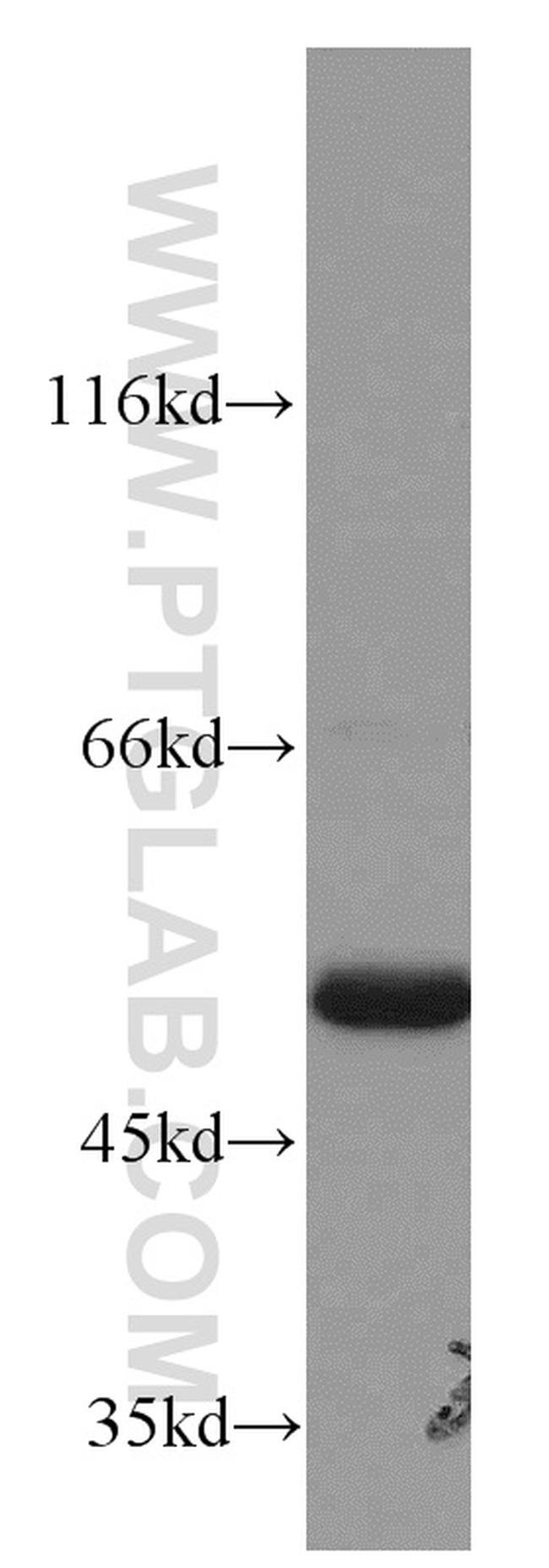 ATP5A1 Antibody in Western Blot (WB)