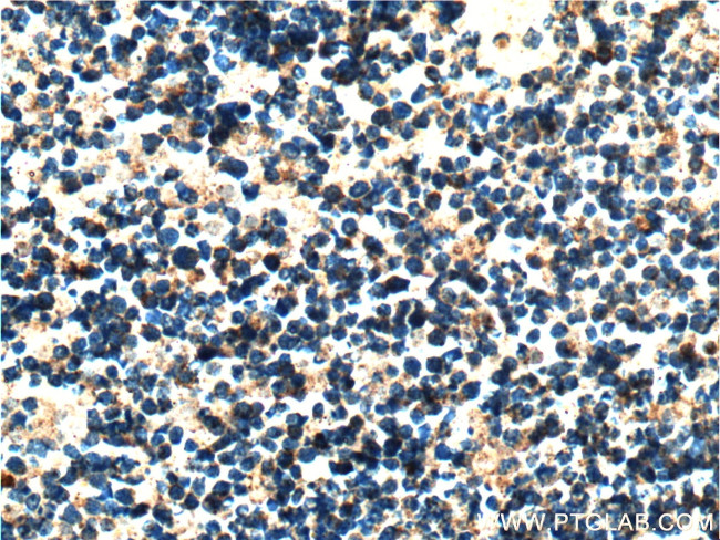 ASNS Antibody in Immunohistochemistry (Paraffin) (IHC (P))