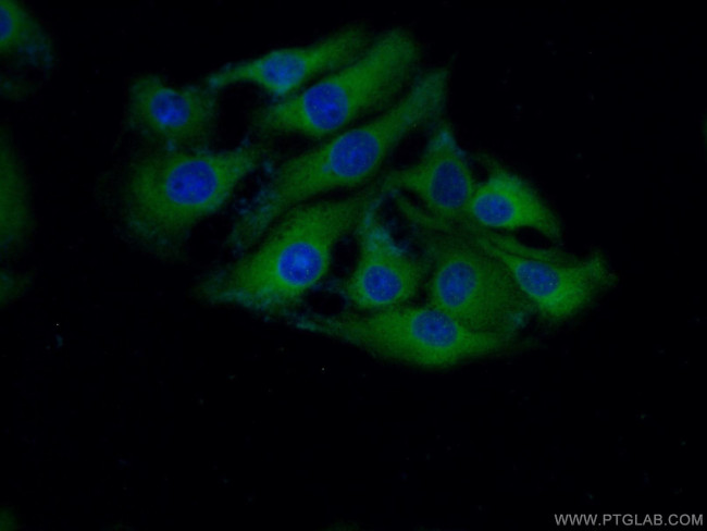 ASNS Antibody in Immunocytochemistry (ICC/IF)